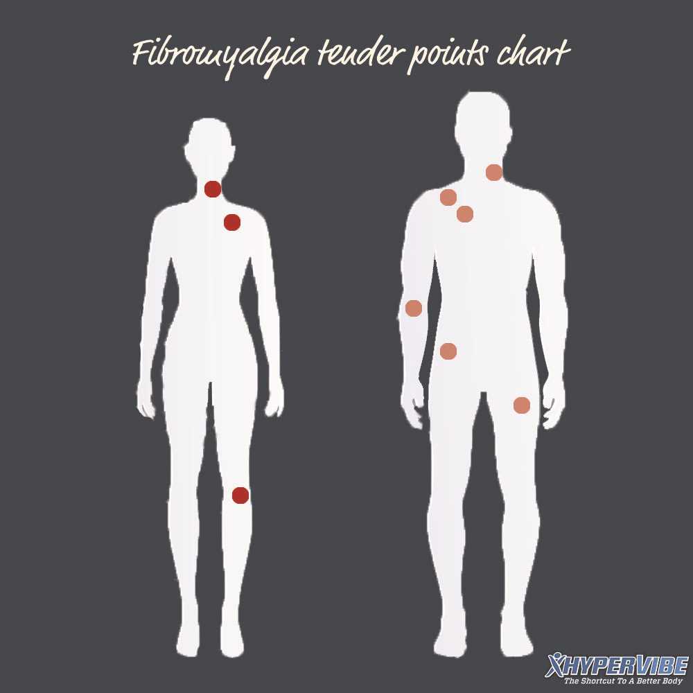 printable trigger points chart
