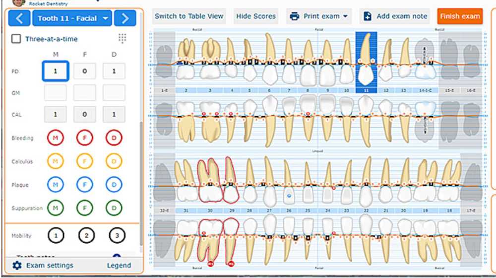 periodontal chart printable