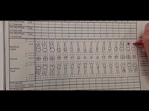 periodontal chart printable