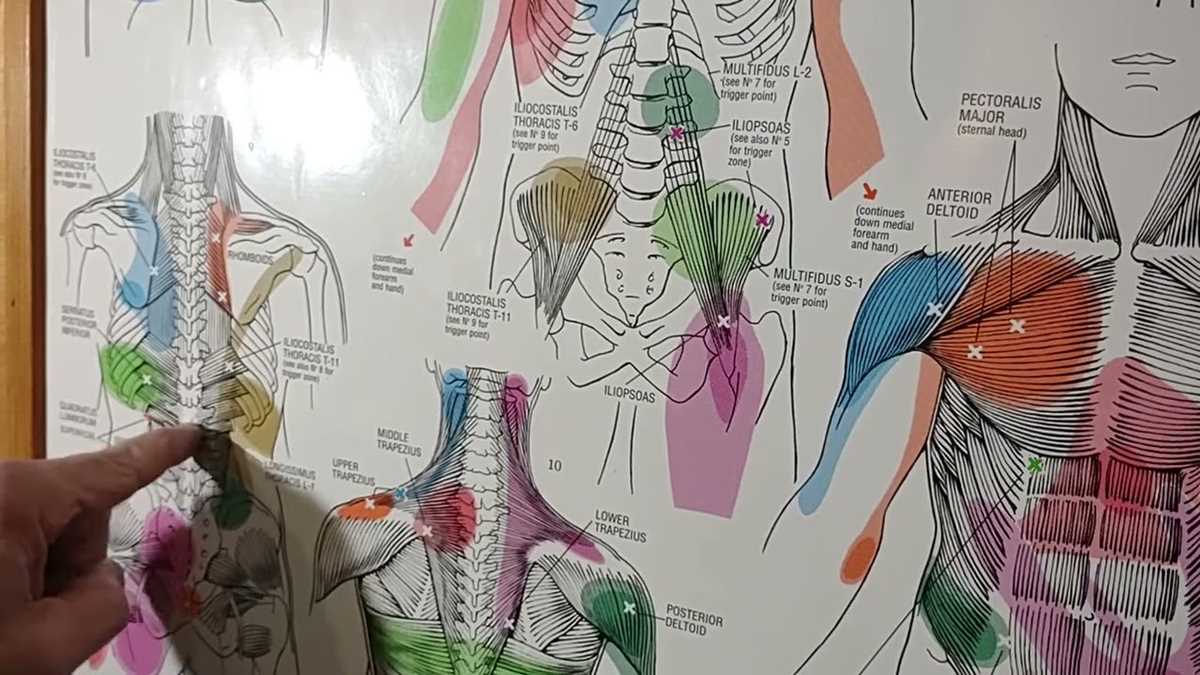 printable trigger points chart