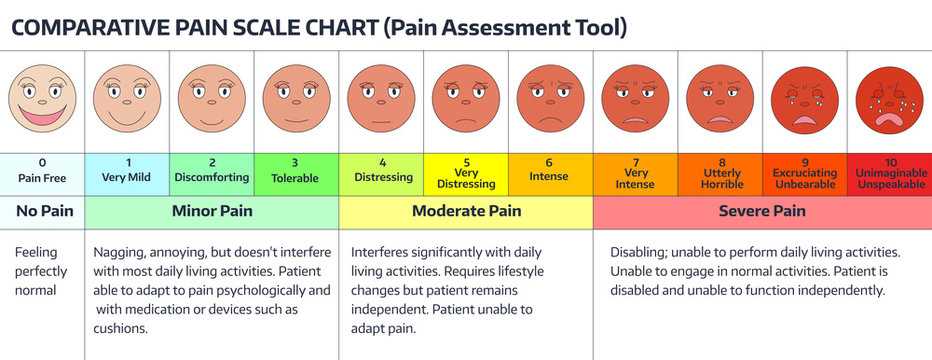 printable pain scale